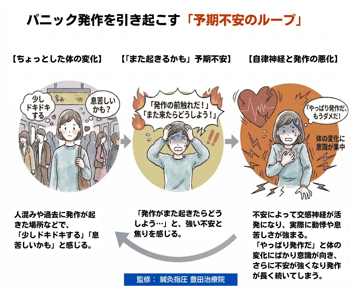 パニック障害の発作を引き起こす「予期不安のループ」と自律神経が悪化するメカニズムの図解