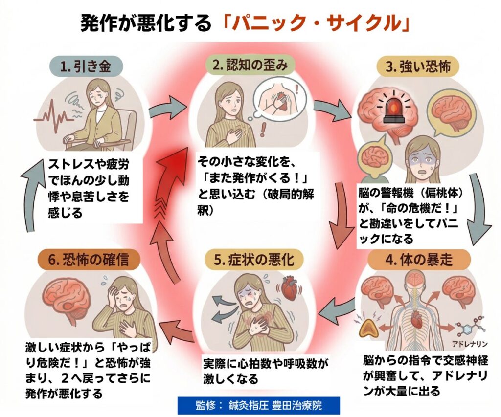 パニック発作が悪化する「パニック・サイクル」図解。認知の歪み、扁桃体の誤作動、交感神経（自律神経）の暴走などによる悪循環のステップ