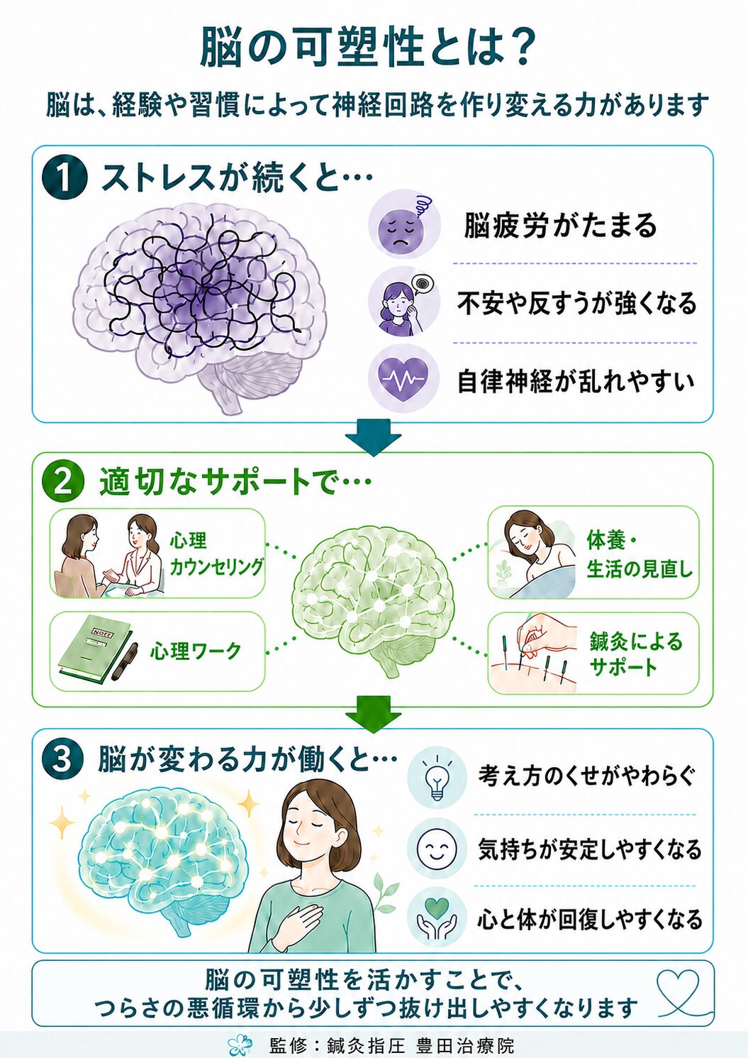 脳の可塑性を説明する図。慢性的なストレスによる脳疲労から、心理カウンセリング・心理ワーク・休養・生活の見直し・鍼灸による心身のサポートを通じて、考え方のくせや気持ちが整いやすくなる流れを示しています。