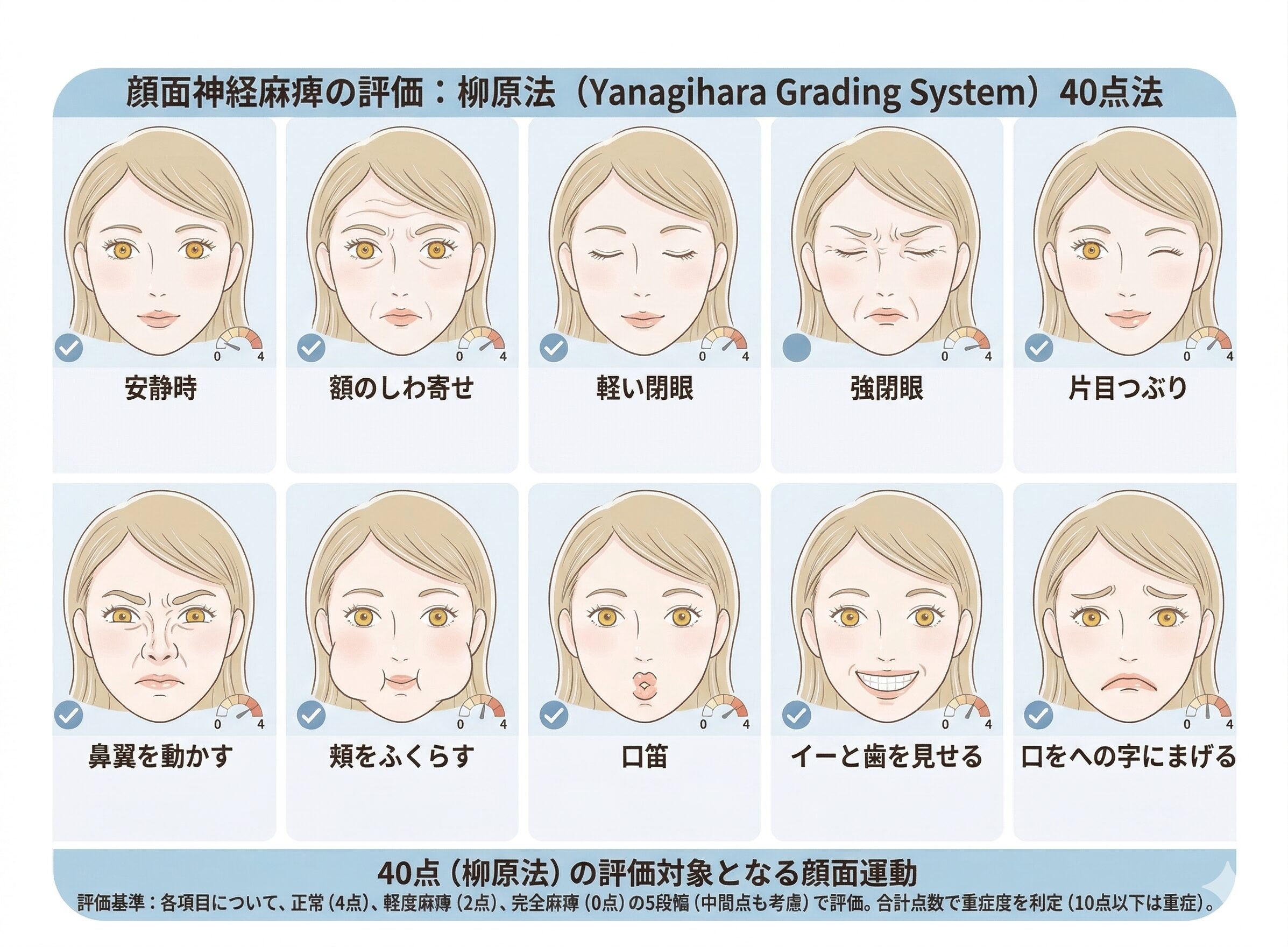 顔面神経麻痺の評価基準（柳原法）